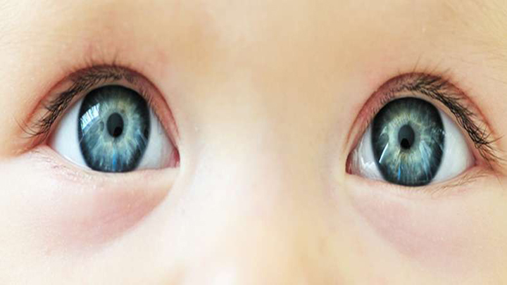 zikamaycauseeyeabnormalitiesininfants